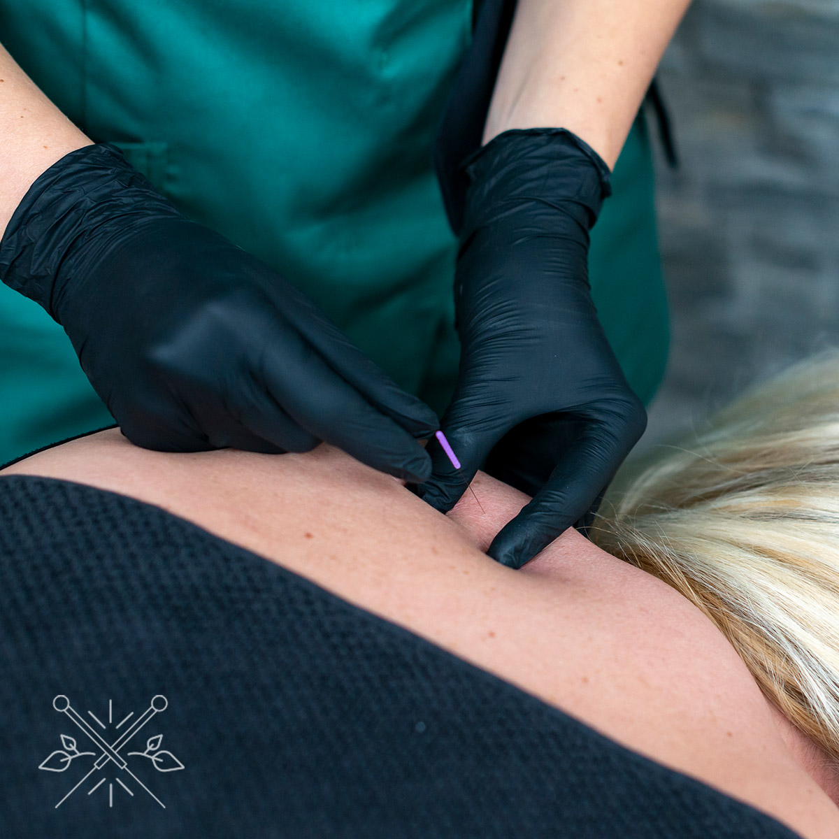 Dry needling Enschede